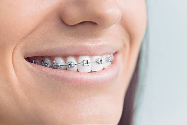 Best Invisalign and Clear Aligners  in Jeffersonville, KY